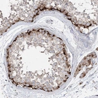 Immunohistochemical staining of human testis shows strong granular cytoplasmic positivity in cells in seminiferous ducts.