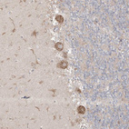 Immunohistochemical staining of human cerebellum shows moderate granular cytoplasmic positivity in Purkinje cells.