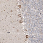 Immunohistochemical staining of human cerebellum shows moderate granular cytoplasmic positivity in Purkinje cells.