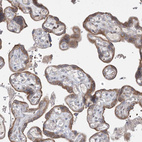 Immunohistochemical staining of human placenta shows moderate granular cytoplasmic positvitiy in trophoblastic cells.