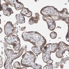 Immunohistochemical staining of human placenta shows moderate granular cytoplasmic positvitiy in trophoblastic cells.