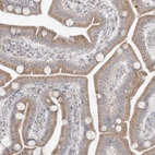 Immunohistochemical staining of human duodenum showes weak granular cytoplasmic positivity in glandular cells.