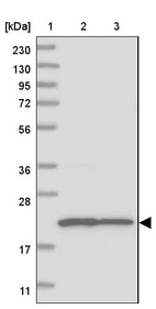 Lane 1: Marker [kDa] 230, 130, 95, 72, 56, 36, 28, 17, 11_br/_Lane 2: Human cell line RT-4_br/_Lane 3: Human cell line U-251MG sp