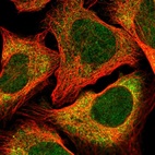 Immunofluorescent staining of human cell line U-2 OS shows localization to cytosol.