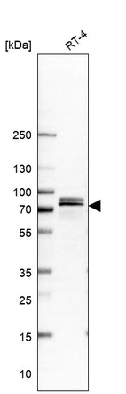 Western blot analysis in human cell line RT-4.