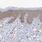 Anti-KIAA1522 Antibody