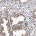 Immunohistochemical staining of human prostate shows moderate membranous positivity in glandular cells.
