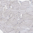 Immunohistochemical staining of human skeletal muscle shows low expression in myocytes as expected.