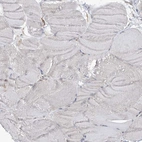 Immunohistochemical staining of human skeletal muscle shows low expression in myocytes as expected.
