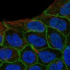 Immunofluorescent staining of human cell line RT4 shows localization to cell junctions.