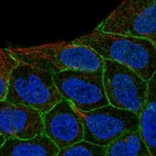 Immunofluorescent staining of human cell line RT4 shows localization to cell junctions.