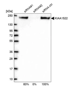 Western blot analysis in U2OS cells transfected with control siRNA, target specific siRNA probe #1 and #2, using Anti-KIAA1522 antibody. Remaining relative intensity is presented.