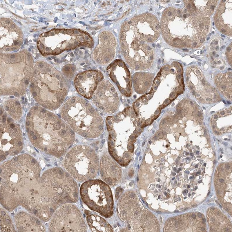 Anti-ZC3H12A Antibody