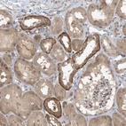 Anti-ZC3H12A Antibody