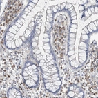 Immunohistochemical staining of human colon shows moderate cytoplasmic positivity in lymphoid cells.