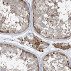 Immunohistochemical staining of human testis shows moderate cytoplasmic and nuclear positivity in Leydig cells.