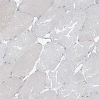 Immunohistochemical staining of human skeletal muscle shows no positivity in myocytes as expected.