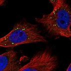 Immunofluorescent staining of human cell line U-251 MG shows localization to cytoplasmic bodies.