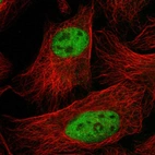 Immunofluorescent staining of human cell line U-2 OS shows localization to nucleoplasm.