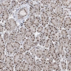 Immunohistochemical staining of human pancreas shows low expression as expected.