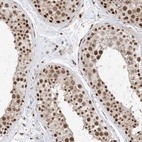 Immunohistochemical staining of human testis shows high expression.