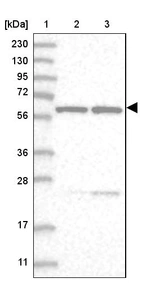 Lane 1: Marker [kDa] 230, 130, 95, 72, 56, 36, 28, 17, 11_br/_Lane 2: Human cell line RT-4_br/_Lane 3: Human cell line U-251 MG
