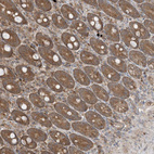 Anti-PUSL1 Antibody