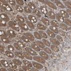 Anti-PUSL1 Antibody