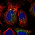 Immunofluorescent staining of human cell line U-2 OS shows localization to vesicles.