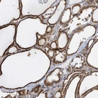 Anti-KLHDC9 Antibody