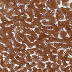 Anti-LSS Antibody