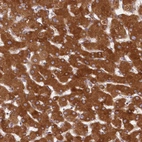 Anti-LSS Antibody