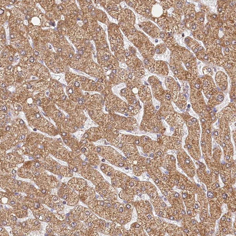 Anti-LSS Antibody