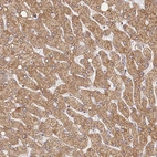 Anti-LSS Antibody