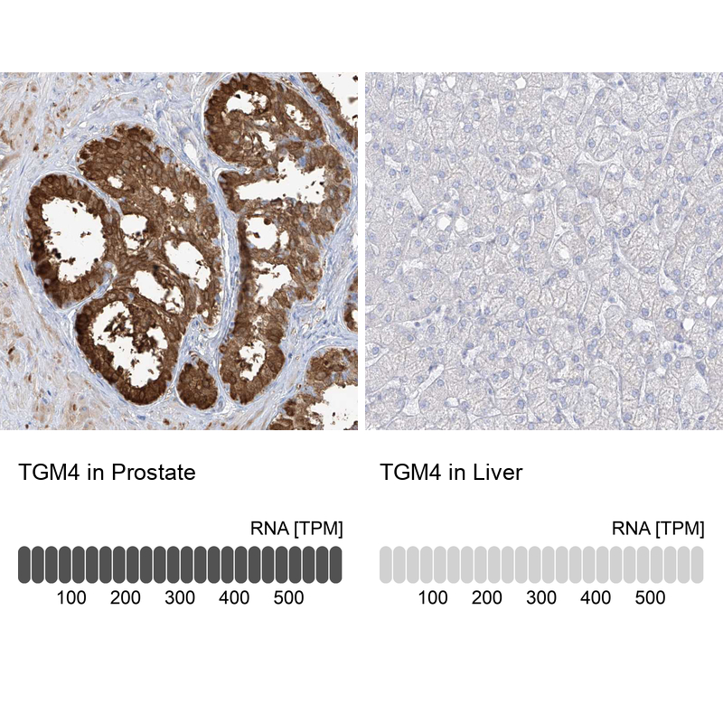 Anti-TGM4 Antibody