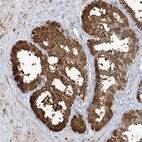 Immunohistochemical staining of human Prostate shows strong granular cytoplasmic positivity in glandular cells.