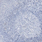 Immunohistochemical staining of human Tonsil shows no positivity in non-germinal center cells as expected.