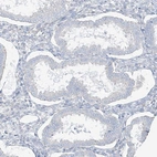 Immunohistochemical staining of human Endometrium shows no positivity in glandular cells as expected.