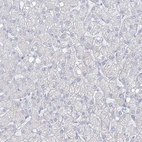 Immunohistochemical staining of human Liver shows no positivity in hepatocytes as expected.