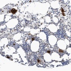 Anti-GPATCH3 Antibody