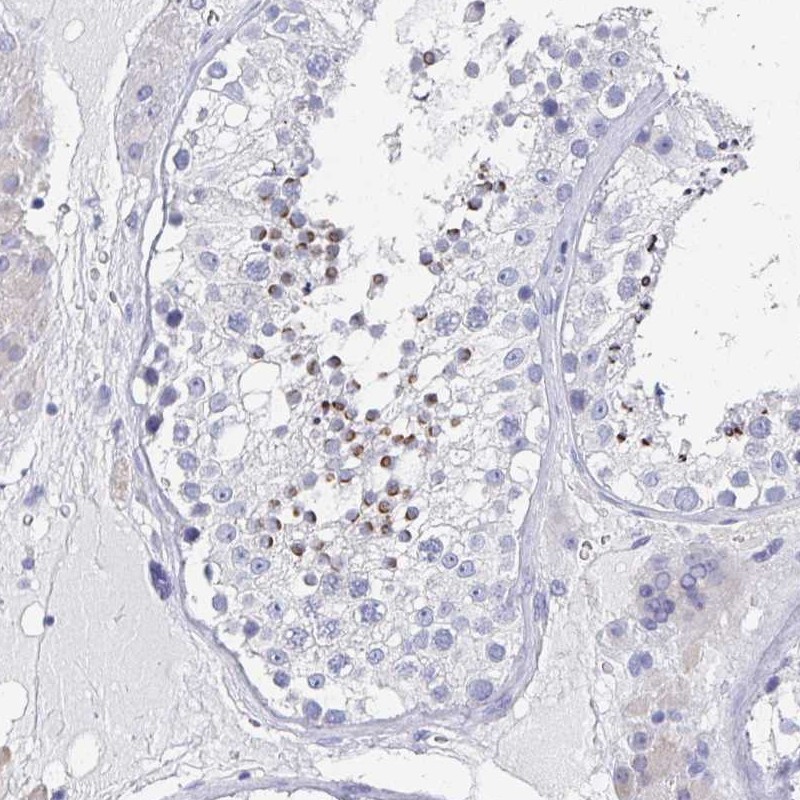 Anti-TNFRSF8 Antibody