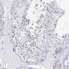 Anti-TNFRSF8 Antibody