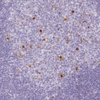 Anti-TNFRSF8 Antibody