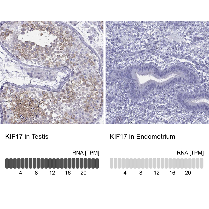 Anti-KIF17 Antibody