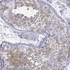 Immunohistochemical staining of human testis shows high expression.