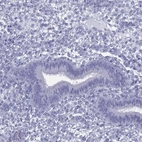 Immunohistochemical staining of human endometrium shows low expression as expected.