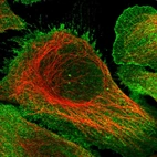 Immunofluorescent staining of human cell line U-2 OS shows localization to nucleoplasm & plasma membrane.