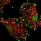 Immunofluorescent staining of human cell line U-251 MG shows localization to nucleoplasm, the Golgi apparatus & focal adhesion sites.
