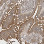 Anti-UHRF1BP1 Antibody