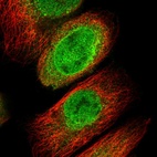 Immunofluorescent staining of human cell line A-431 shows localization to nucleoplasm, nuclear membrane & cytosol.